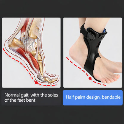 FootAlign™ Support Brace